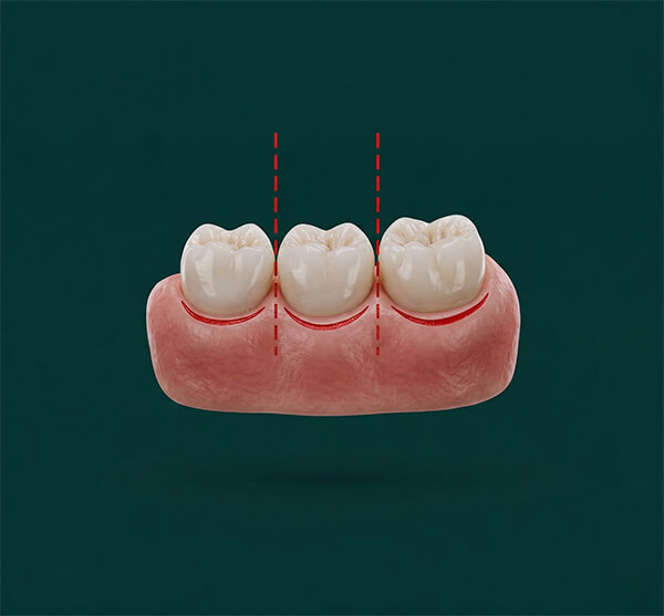 Digital Smile