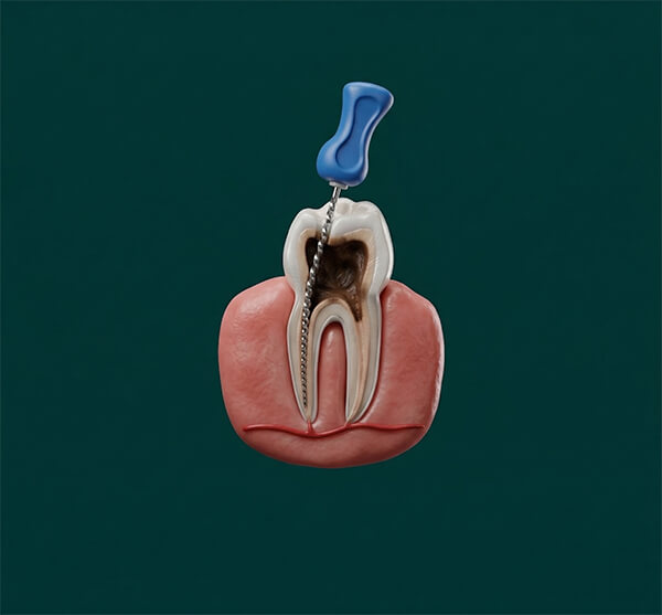 Endodontics