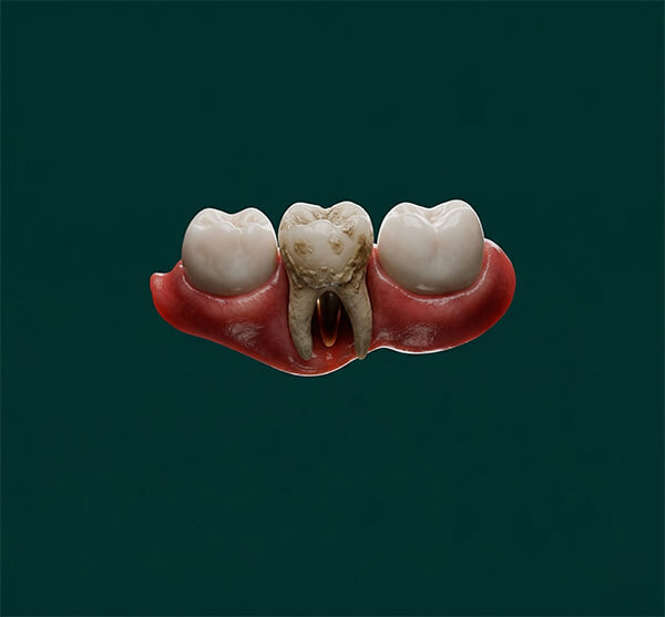 Periodontology