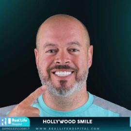 dental implants 2361