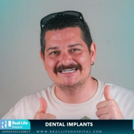 dental implants 9746