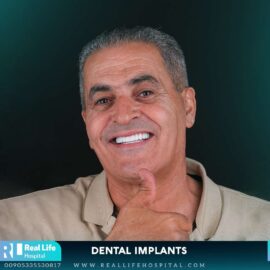 dental implants 97461