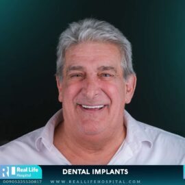 dental implants 974613