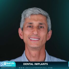 dental implants 9746139
