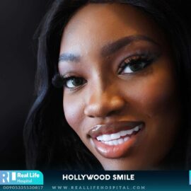 hollywood smile 131347