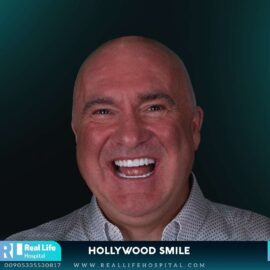 hollywood smile 2602