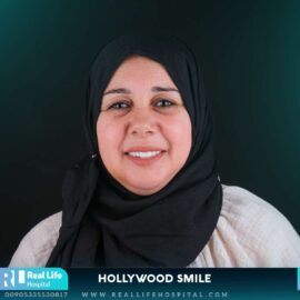 hollywood smile 64972