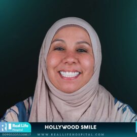 hollywood smile 649729