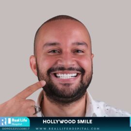 hollywood smile 6921