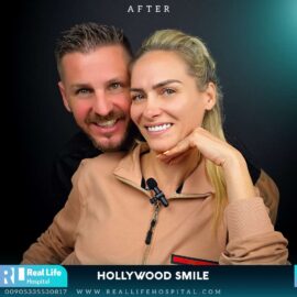 hollywood smile real life 12341241
